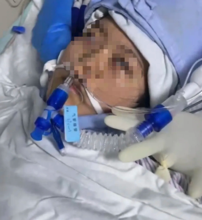 22岁女子手术成功后脑死亡家属：缺氧30分钟医生未发觉医院回应(图1)
